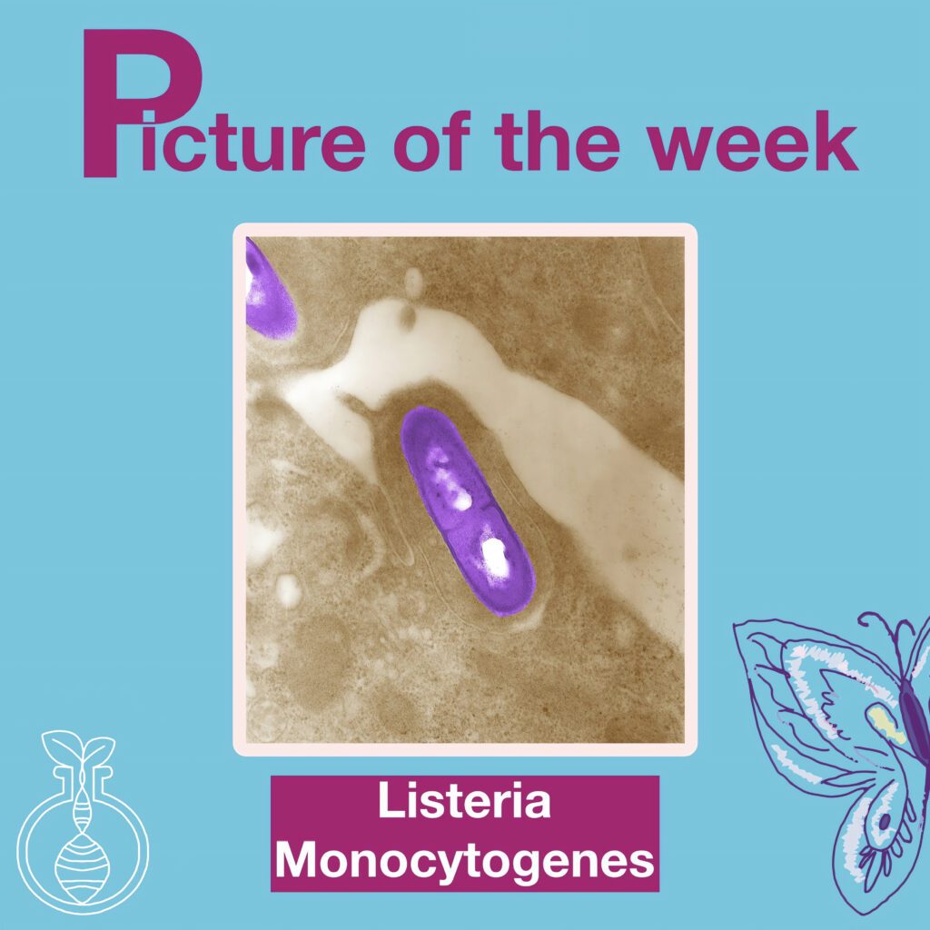 Listeria Monocytogenes