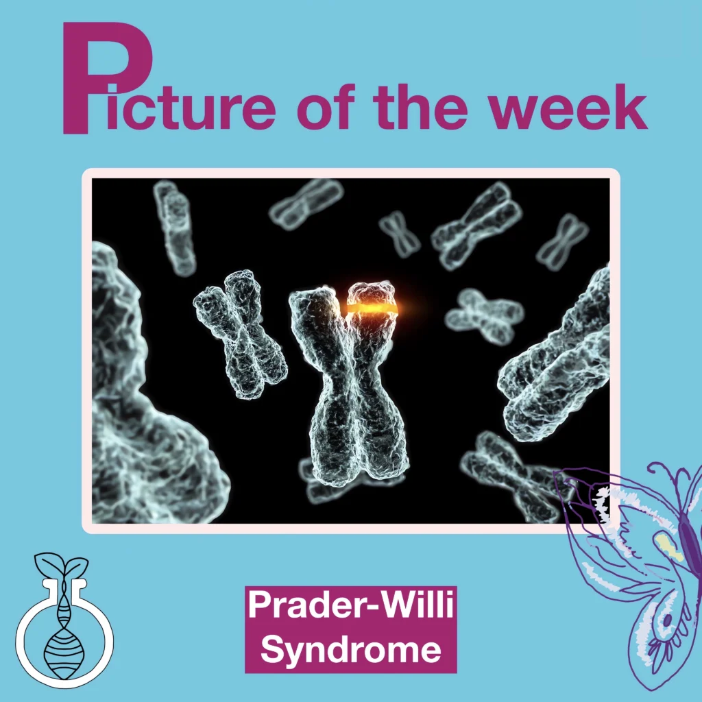 Prader-Willi Syndrome: A Journey Through a Complex Genetic Puzzle