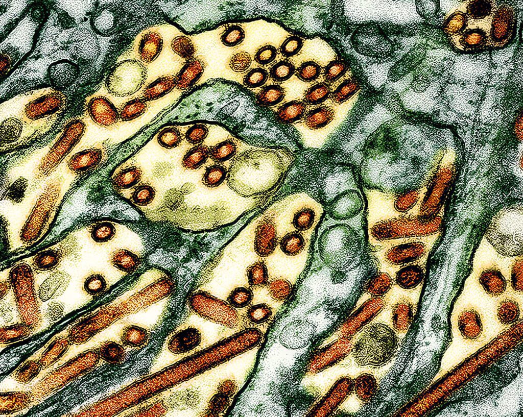 H5N1 virus under microscope