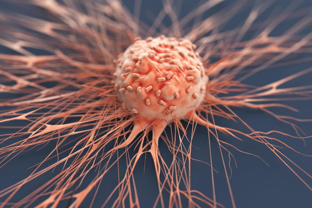 a cancer cell that has begun to develop into a tumor